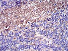 FGG / Fibrinogen Gamma Antibody - IHC of paraffin-embedded cerebellum tissues using FGG mouse monoclonal antibody with DAB staining.