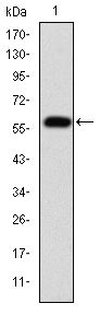 FGG / Fibrinogen Gamma Antibody - Fibrinogen gamma Antibody in Western Blot (WB)