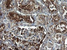 FGG / Fibrinogen Gamma Antibody - IHC of paraffin-embedded Human Kidney tissue using anti-FGG mouse monoclonal antibody. (Heat-induced epitope retrieval by 1 mM EDTA in 10mM Tris, pH8.5, 120°C for 3min).