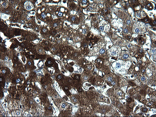 FGG / Fibrinogen Gamma Antibody - IHC of paraffin-embedded Human liver tissue using anti-FGG mouse monoclonal antibody. (Heat-induced epitope retrieval by 1 mM EDTA in 10mM Tris, pH8.5, 120°C for 3min).