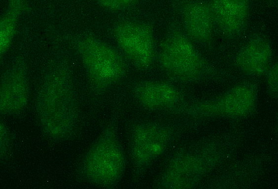 FGG / Fibrinogen Gamma Antibody - Immunofluorescent staining of HeLa cells using anti-FGG mouse monoclonal antibody.