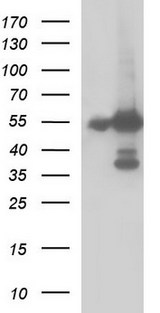 FGG / Fibrinogen Gamma Antibody - HEK293T cells were transfected with the pCMV6-ENTRY control (Left lane) or pCMV6-ENTRY FGG (Right lane) cDNA for 48 hrs and lysed. Equivalent amounts of cell lysates (5 ug per lane) were separated by SDS-PAGE and immunoblotted with anti-FGG.