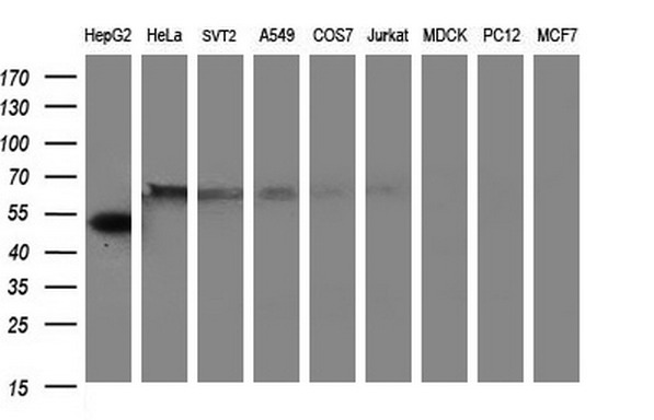 FGG / Fibrinogen Gamma Antibody - Western blot of extracts (35ug) from 9 different cell lines by using anti-FGG monoclonal antibody (HepG2: human; HeLa: human; SVT2: mouse; A549: human; COS7: monkey; Jurkat: human; MDCK: canine; PC12: rat; MCF7: human).