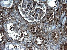 FGG / Fibrinogen Gamma Antibody - IHC of paraffin-embedded Human Kidney tissue using anti-FGG mouse monoclonal antibody. (Heat-induced epitope retrieval by 1 mM EDTA in 10mM Tris, pH8.5, 120°C for 3min).
