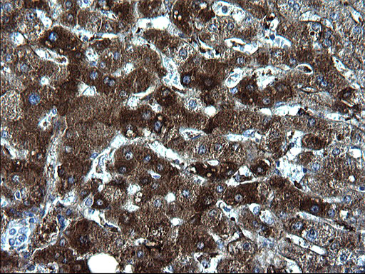 FGG / Fibrinogen Gamma Antibody - IHC of paraffin-embedded Human liver tissue using anti-FGG mouse monoclonal antibody. (Heat-induced epitope retrieval by 1 mM EDTA in 10mM Tris, pH8.5, 120°C for 3min).