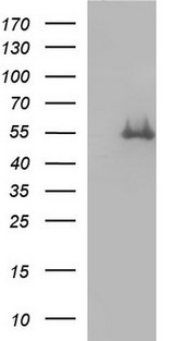 FGG / Fibrinogen Gamma Antibody - HEK293T cells were transfected with the pCMV6-ENTRY control (Left lane) or pCMV6-ENTRY FGG (Right lane) cDNA for 48 hrs and lysed. Equivalent amounts of cell lysates (5 ug per lane) were separated by SDS-PAGE and immunoblotted with anti-FGG.