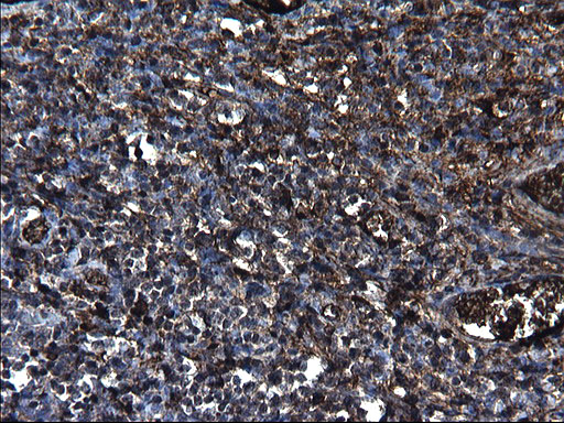 FGG / Fibrinogen Gamma Antibody - IHC of paraffin-embedded Human lymph node tissue using anti-FGG mouse monoclonal antibody. (Heat-induced epitope retrieval by 1 mM EDTA in 10mM Tris, pH8.5, 120°C for 3min).