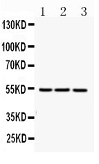 FGG / Fibrinogen Gamma Antibody - Western blot - Anti-FGG Picoband Antibody