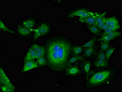 FGG / Fibrinogen Gamma Antibody - Immunofluorescent analysis of Hela cells diluted at 1:100 and Alexa Fluor 488-congugated AffiniPure Goat Anti-Rabbit IgG(H+L)