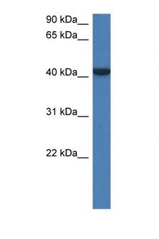 FGGY Antibody - Fggy antibody Western blot of Mouse Kidney lysate. Antibody concentration 1 ug/ml.  This image was taken for the unconjugated form of this product. Other forms have not been tested.
