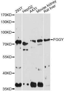 FGGY Antibody - Western blot analysis of extracts of various cell lines, using FGGY antibody at 1:1000 dilution. The secondary antibody used was an HRP Goat Anti-Rabbit IgG (H+L) at 1:10000 dilution. Lysates were loaded 25ug per lane and 3% nonfat dry milk in TBST was used for blocking. An ECL Kit was used for detection and the exposure time was 90s.