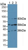 FGL1 / Hepassocin Antibody - Western Blot; Sample: Lane1: Human Liver Tissue; Lane2: Human HepG2 Cells; Lane3: Human Hela Cells.