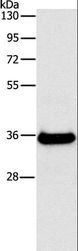 FGL1 / Hepassocin Antibody - Western blot analysis of Human fetal liver tissue, using FGL1 Polyclonal Antibody at dilution of 1:500.