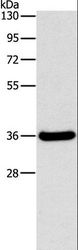 FGL1 / Hepassocin Antibody - Western blot analysis of Human fetal liver tissue, using FGL1 Polyclonal Antibody at dilution of 1:1050.