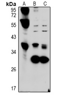 FGL1 / Hepassocin Antibody - Western blot analysis of Hepassocin expression in rat liver (A), LO2 (B), A549 (C) whole cell lysates.