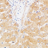 FGL1 / Hepassocin Antibody - Immunohistochemical analysis of Hepassocin staining in human liver formalin fixed paraffin embedded tissue section. The section was pre-treated using heat mediated antigen retrieval with sodium citrate buffer (pH 6.0). The section was then incubated with the antibody at room temperature and detected using an HRP conjugated compact polymer system. DAB was used as the chromogen. The section was then counterstained with haematoxylin and mounted with DPX.