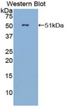 FGL2 Antibody - Western blot of recombinant FGL2.