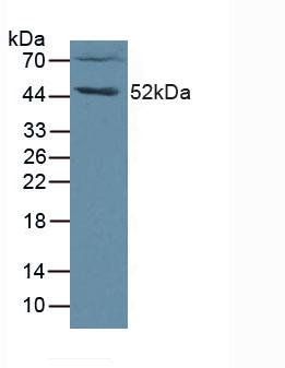 FGL2 Antibody - Western Blot; Sample: Human Jurkat Cells.