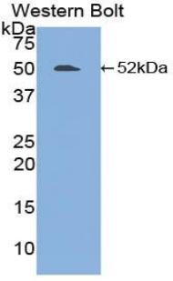 FGL2 Antibody - Western blot of recombinant FGL2.