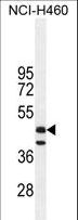 FGL2 Antibody - FGL2 Antibody western blot of NCI-H460 cell line lysates (35 ug/lane). The FGL2 antibody detected the FGL2 protein (arrow).