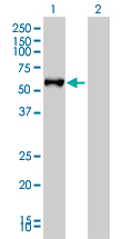 FGL2 Antibody - Western blot of FGL2 expression in transfected 293T cell line by FGL2 monoclonal antibody (M01), clone 6D9.