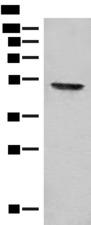 FGL2 Antibody - Western blot analysis of Mouse thymus tissue lysate  using FGL2 Polyclonal Antibody at dilution of 1:300