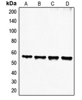 FGL2 Antibody - Western blot analysis of FGL2 expression in HeLa (A); Jurkat (B); HuT78 (C); Molt4 (D) whole cell lysates.