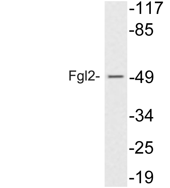 FGL2 Antibody - Western blot of Fgl2 (V38) pAb in extracts from 293 cells treated with insulin.