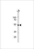 FGR Antibody - Western blot of lysate from rat L6 cell line, using Fgr antibody diluted at 1:1000. A goat anti-rabbit IgG H&L (HRP) at 1:10000 dilution was used as the secondary antibody. Lysate at 20 ug.
