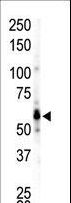 FGR Antibody - The anti-FGR antibody is used in Western blot to detect FGR in Ramos cell lysate.