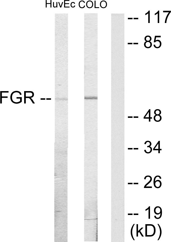 FGR Antibody - Western blot analysis of lysates from HUVEC and COLO205 cells, using FGR Antibody. The lane on the right is blocked with the synthesized peptide.
