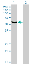 FGR Antibody - Western blot of FGR expression in transfected 293T cell line by FGR monoclonal antibody (M03), clone 1B12.