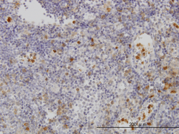 FGR Antibody - Immunoperoxidase of monoclonal antibody to FGR on formalin-fixed paraffin-embedded human lymph node. [antibody concentration 3 ug/ml]