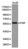 FGR Antibody - Western blot analysis of extracts of HL60 cell lines.