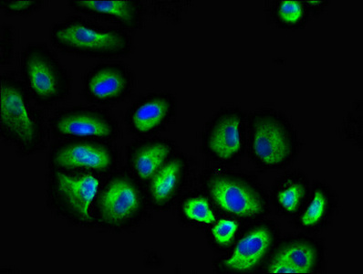 FGR Antibody - Immunofluorescent analysis of A549 cells diluted at 1:100 and Alexa Fluor 488-congugated AffiniPure Goat Anti-Rabbit IgG(H+L)