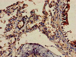 FGR Antibody - Immunohistochemistry of paraffin-embedded human lung tissue at dilution of 1:100