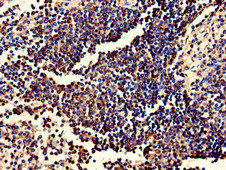 FGR Antibody - Immunohistochemistry of paraffin-embedded human spleen tissue at dilution of 1:100