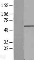 FGR Protein - Western validation with an anti-DDK antibody * L: Control HEK293 lysate R: Over-expression lysate