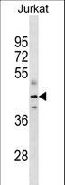 FH / Fumarase / MCL Antibody - FH Antibody (Ascites)western blot of Jurkat cell line lysates (35 ug/lane). The FH antibody detected the FH protein (arrow).