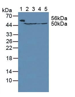 FH / Fumarase / MCL Antibody - Western Blot; Sample: Lane1: Mouse Serum; Lane2: Mouse Liver Tissue; Lane3: Rat Liver TissueL; Lane4: Mouse Placenta Tissue; Lane5: Human Hela Cells.
