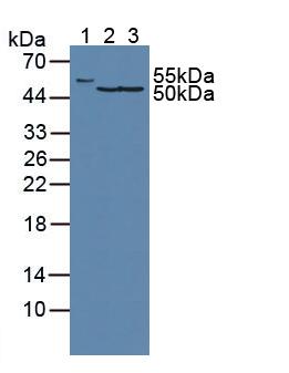 FH / Fumarase / MCL Antibody - Western Blot; Sample: Lane1: Human Serum; Lane2: Human Hela Cells; Lane3: Porcine Liver Tissue.