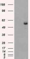 FH / Fumarase / MCL Antibody - HEK293T cells were transfected with the pCMV6-ENTRY control (Left lane) or pCMV6-ENTRY FH (Right lane) cDNA for 48 hrs and lysed. Equivalent amounts of cell lysates (5 ug per lane) were separated by SDS-PAGE and immunoblotted with anti-FH.