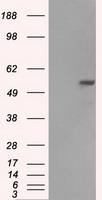 FH / Fumarase / MCL Antibody - HEK293T cells were transfected with the pCMV6-ENTRY control (Left lane) or pCMV6-ENTRY FH (Right lane) cDNA for 48 hrs and lysed. Equivalent amounts of cell lysates (5 ug per lane) were separated by SDS-PAGE and immunoblotted with anti-FH.