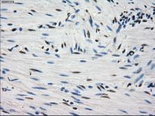 FH / Fumarase / MCL Antibody - IHC of paraffin-embedded colon tissue using anti-FH mouse monoclonal antibody. (Dilution 1:50).
