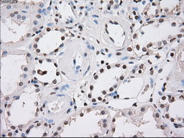 FH / Fumarase / MCL Antibody - IHC of paraffin-embedded Kidney tissue using anti-FH mouse monoclonal antibody. (Dilution 1:50).