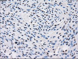 FH / Fumarase / MCL Antibody - IHC of paraffin-embedded endometrium tissue using anti-FH mouse monoclonal antibody. (Dilution 1:50).