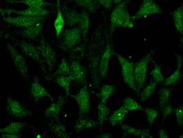 FH / Fumarase / MCL Antibody - Immunofluorescent staining of HeLa cells using anti-FH mouse monoclonal antibody.