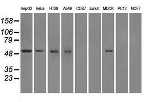 FH / Fumarase / MCL Antibody - Western blot of extracts (35 ug) from 9 different cell lines by using anti-FH monoclonal antibody.