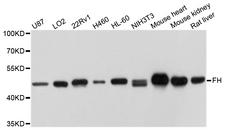 FH / Fumarase / MCL Antibody - Western blot analysis of extracts of various cell lines.