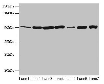 FH / Fumarase / MCL Antibody - Western blot All lanes: FH antibody at 12µg/ml Lane 1: Mouse heart tissue Lane 2: Mouse liver tissue Lane 3: Mouse kidney tissue Lane 4: Mouse brain tissue Lane 5: Human placenta tissue Lane 6: Hela whole cell lysate Lane 7: HepG2 whole cell lysate Secondary Goat polyclonal to rabbit IgG at 1/10000 dilution Predicted band size: 55, 51 kDa Observed band size: 55 kDa
